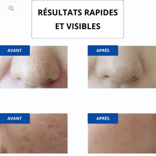 Masque luminothérapie LED | Éclat et anti-âge
