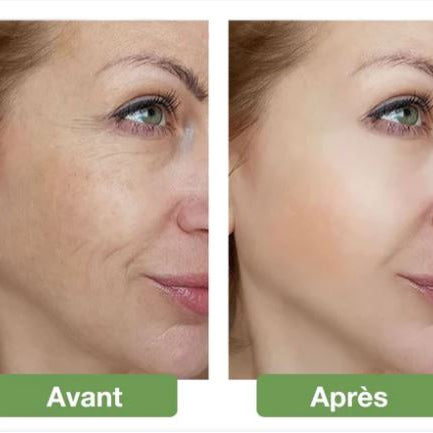 Masque luminothérapie LED | Éclat et anti-âge