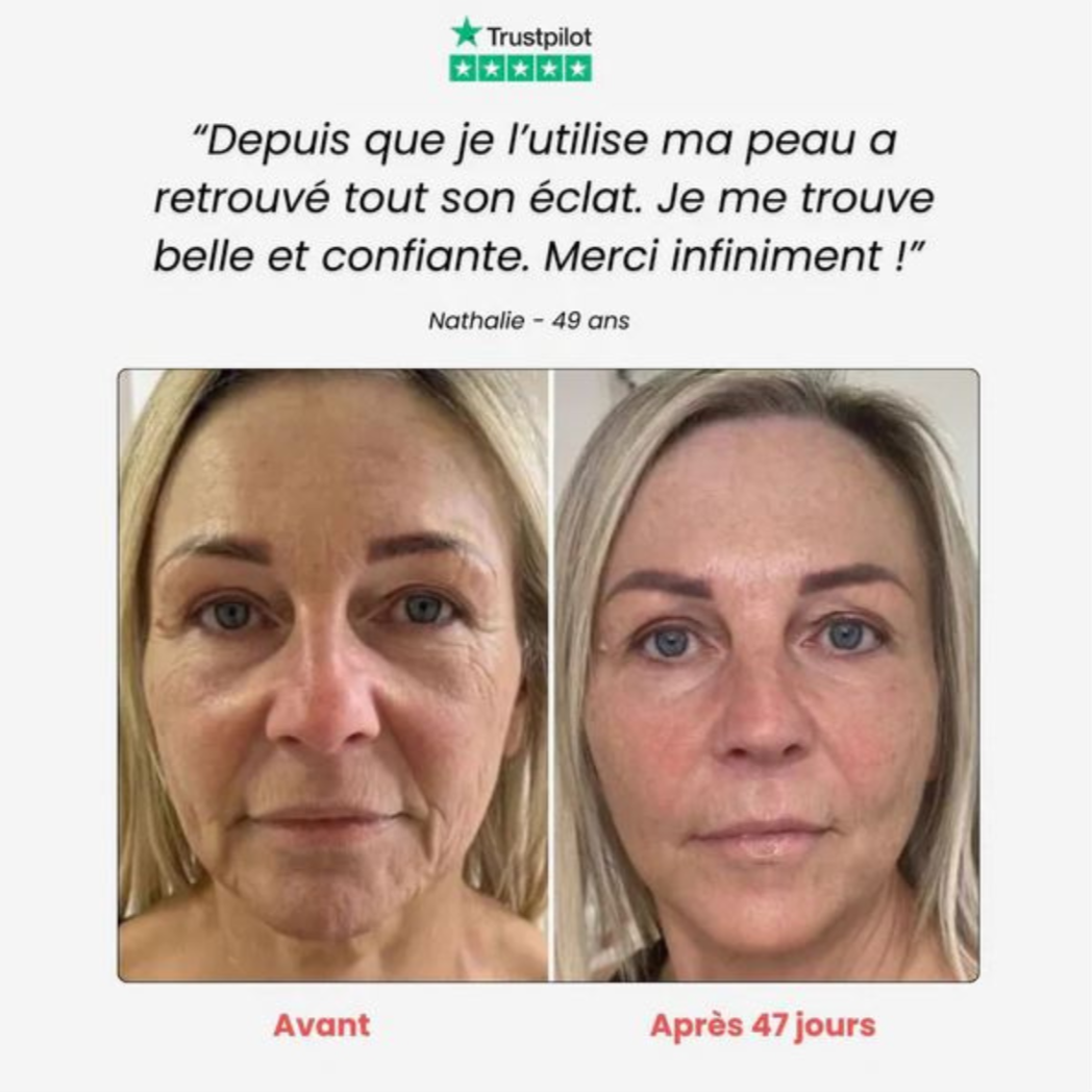 MagicSkin - Masseur visage anti-rides