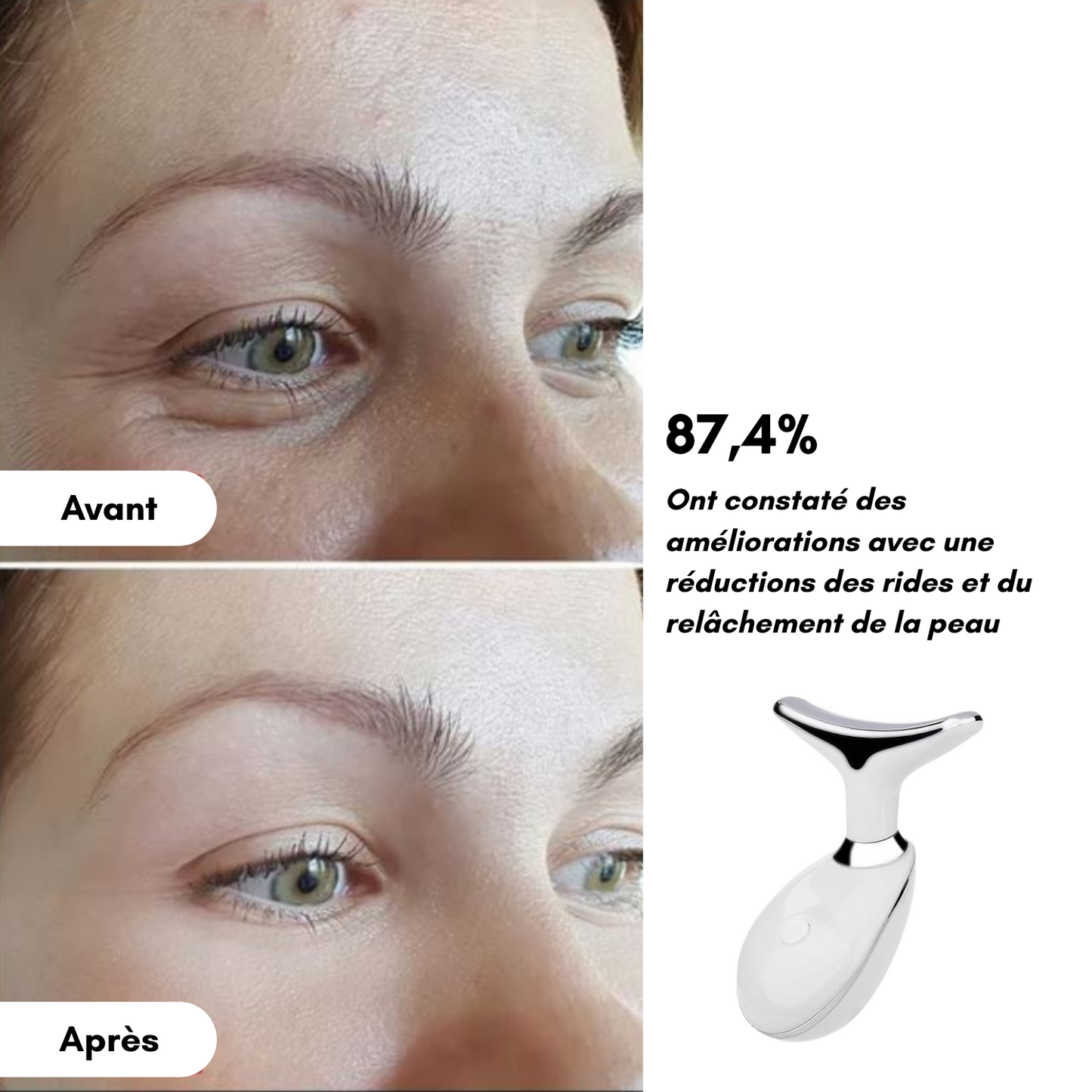 MagicSkin - Masseur visage LED anti-rides