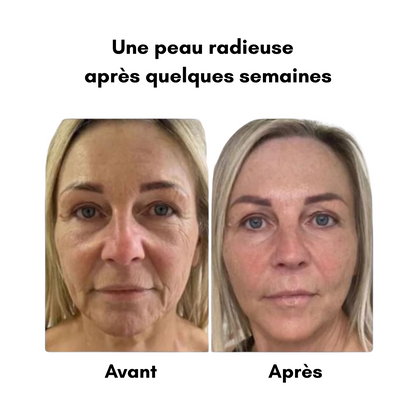 MagicSkin - Masseur visage LED anti-rides