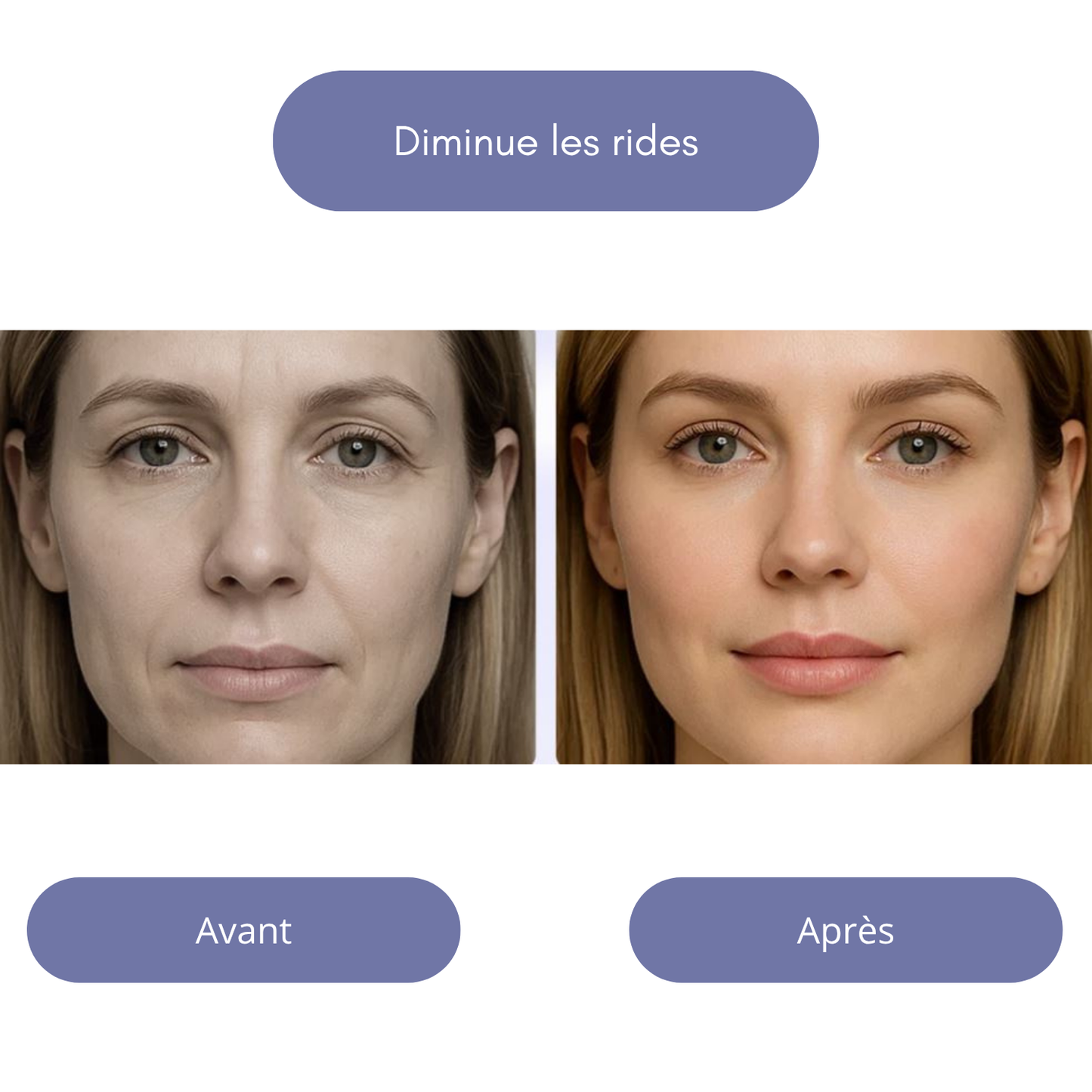 NeoLumen | Luminothérapie LED visage et corps