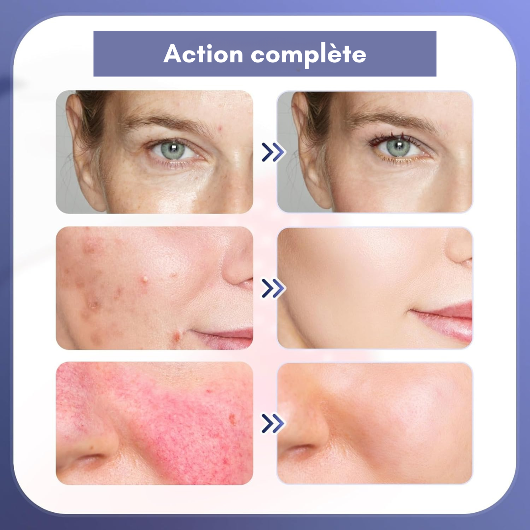 Appareil de soin visage & corps | Luminothérapie LED