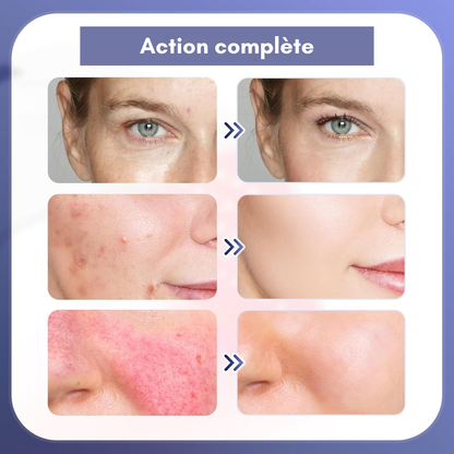 Appareil de soin visage & corps | Luminothérapie LED