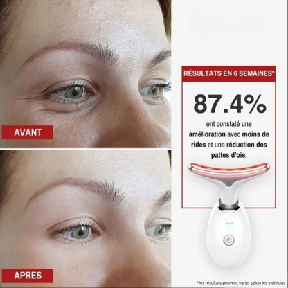 MagicSkin - Masseur visage anti-rides