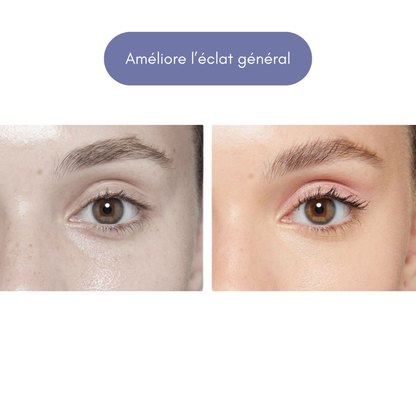 Appareil de soin visage & corps | Luminothérapie LED